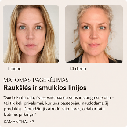 Kaklo stangrinimo volelis