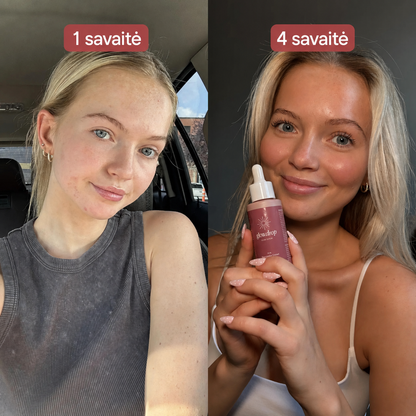 Glowdrop – Geriami Įdegio Lašai Saulės Nubučiuotai Odai Iš Vidaus