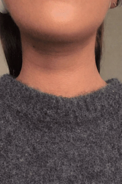 PO