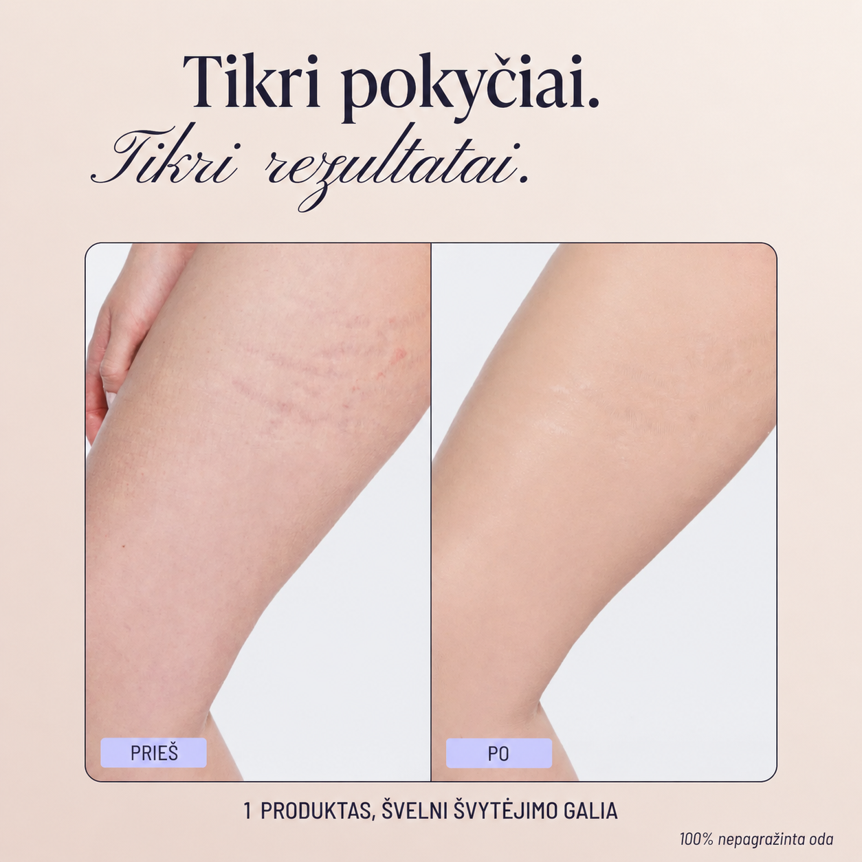 Kūno maskuojamasis tobulintuvas