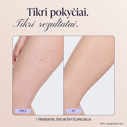 Kūno maskuojamasis tobulintuvas