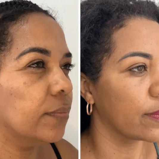 Korėjietiška jauninamasis kolageno kaukė – Collagen Fit™