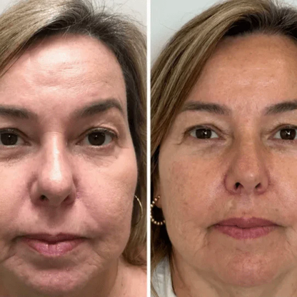 Korėjietiška jauninamasis kolageno kaukė – Collagen Fit™
