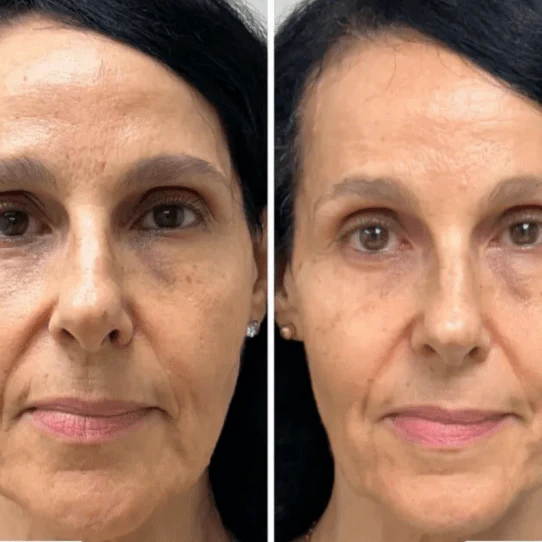 Korėjietiška jauninamasis kolageno kaukė – Collagen Fit™